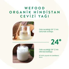 Organik Hindistan Cevizi Yağı 150 ml (Soğuk Sıkım)